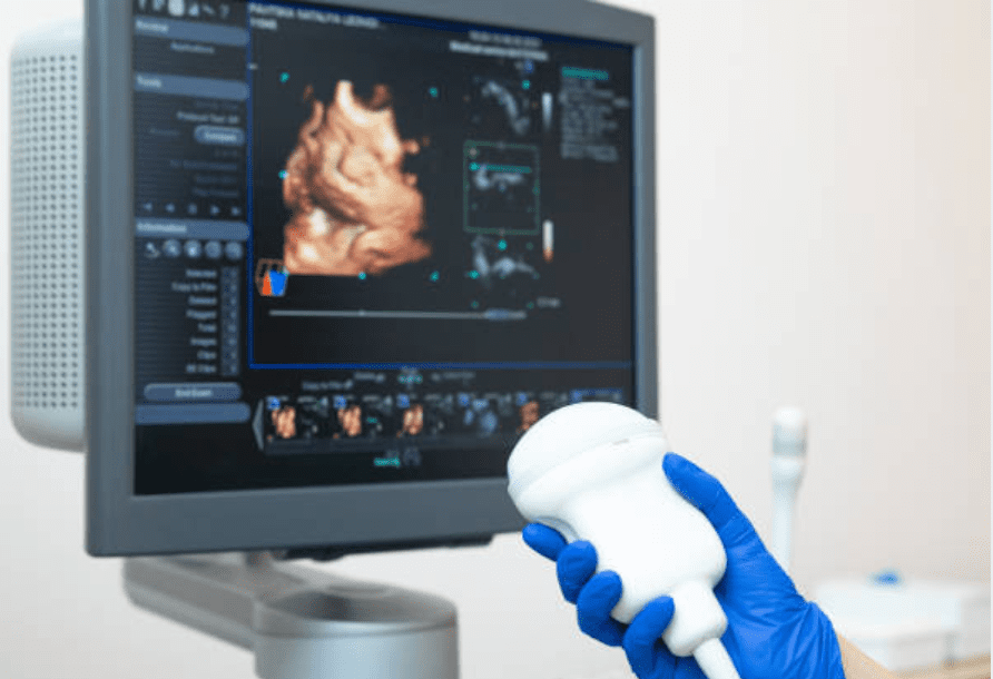 Color Doppler