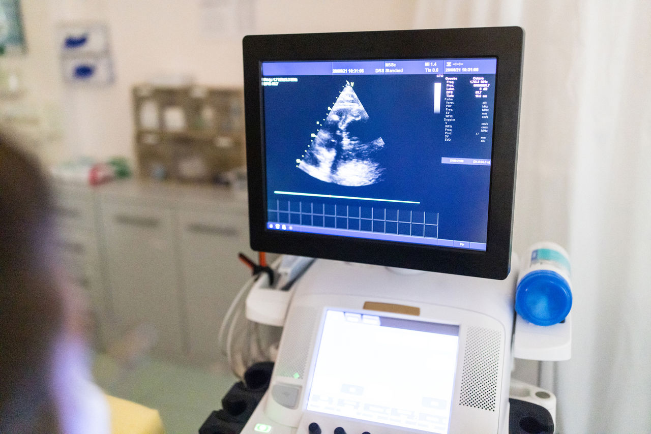 Sonography