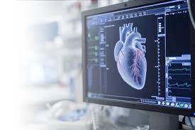 Echo ECG